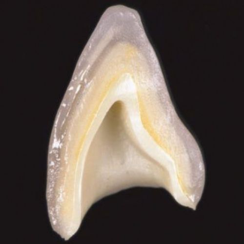 imágenes de prótesis dentales
