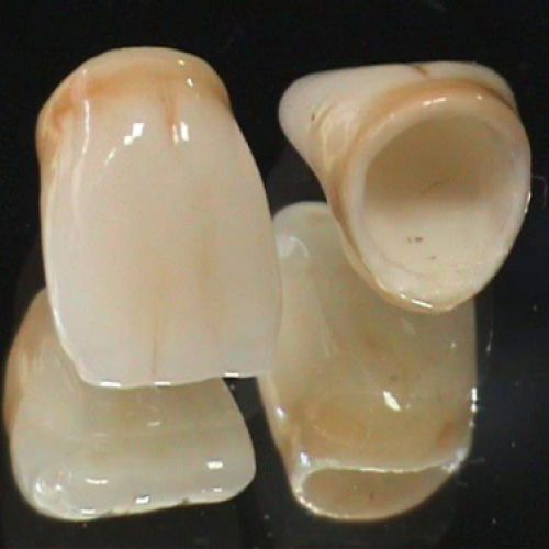 imágenes de prótesis dentales