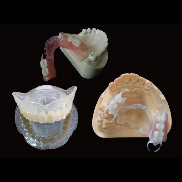 Prótesis dental removible Prótesis dental removible