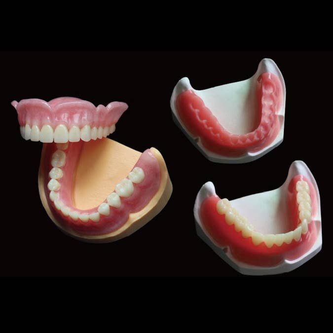 Prótesis acrílicas