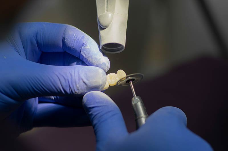 Laboratorio de prótesis dentales